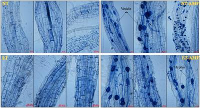 Non-targeted metabolomics analysis reveals the mechanism of arbuscular mycorrhizal symbiosis regulating the cold-resistance of Elymus nutans